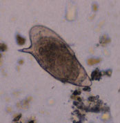 Schistosoma eggs. Source: CDC